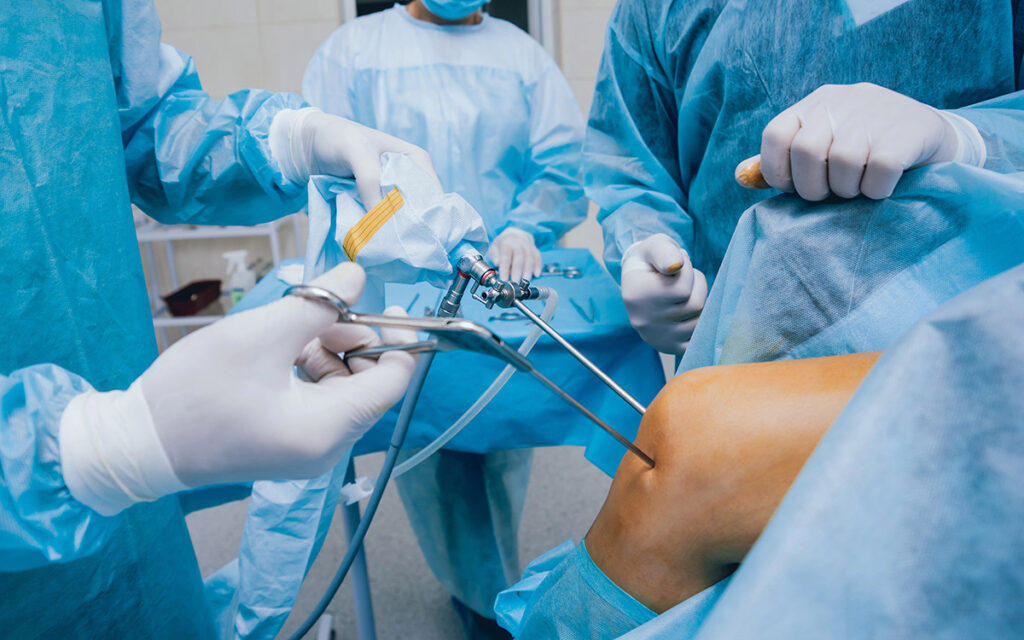 Arthroscopy surgery